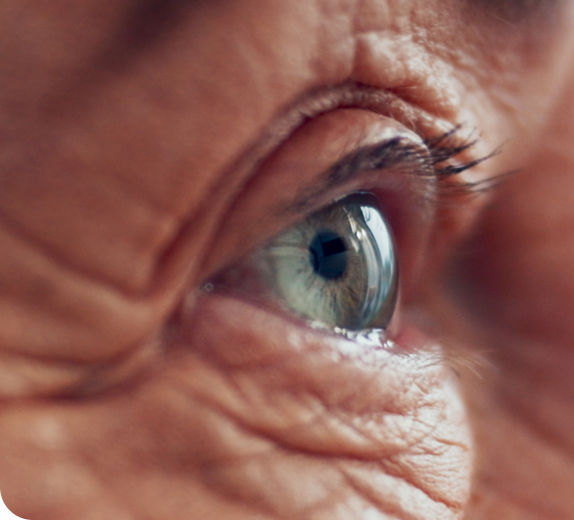 Close-up of aging human eye